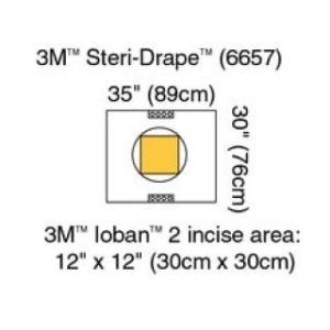 Steri-Drape Pouch with Ioban 2 Incise Film  Incise area: 11 x 11 (30cm x 30cm)  10BX  4 BXCS - 6657